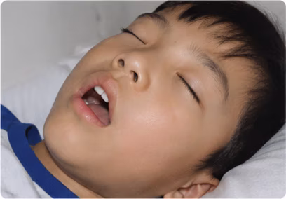 Child sleeping with their mouth open