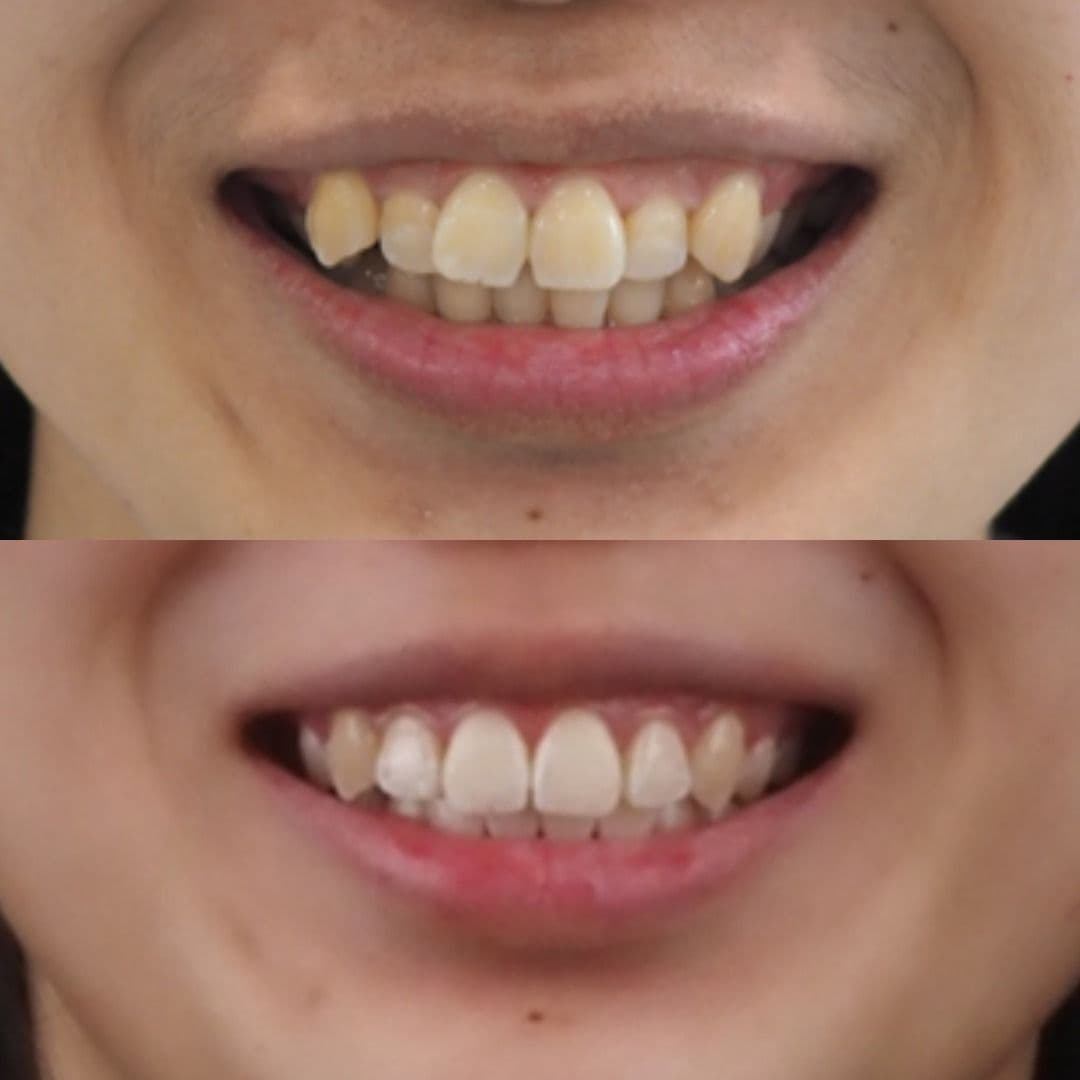 Aloha Dental smile result 5