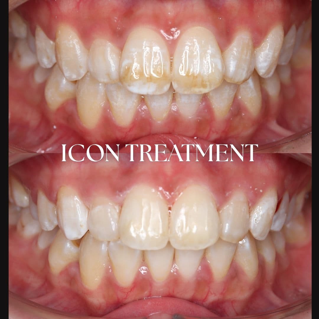 Aloha Dental smile result 4