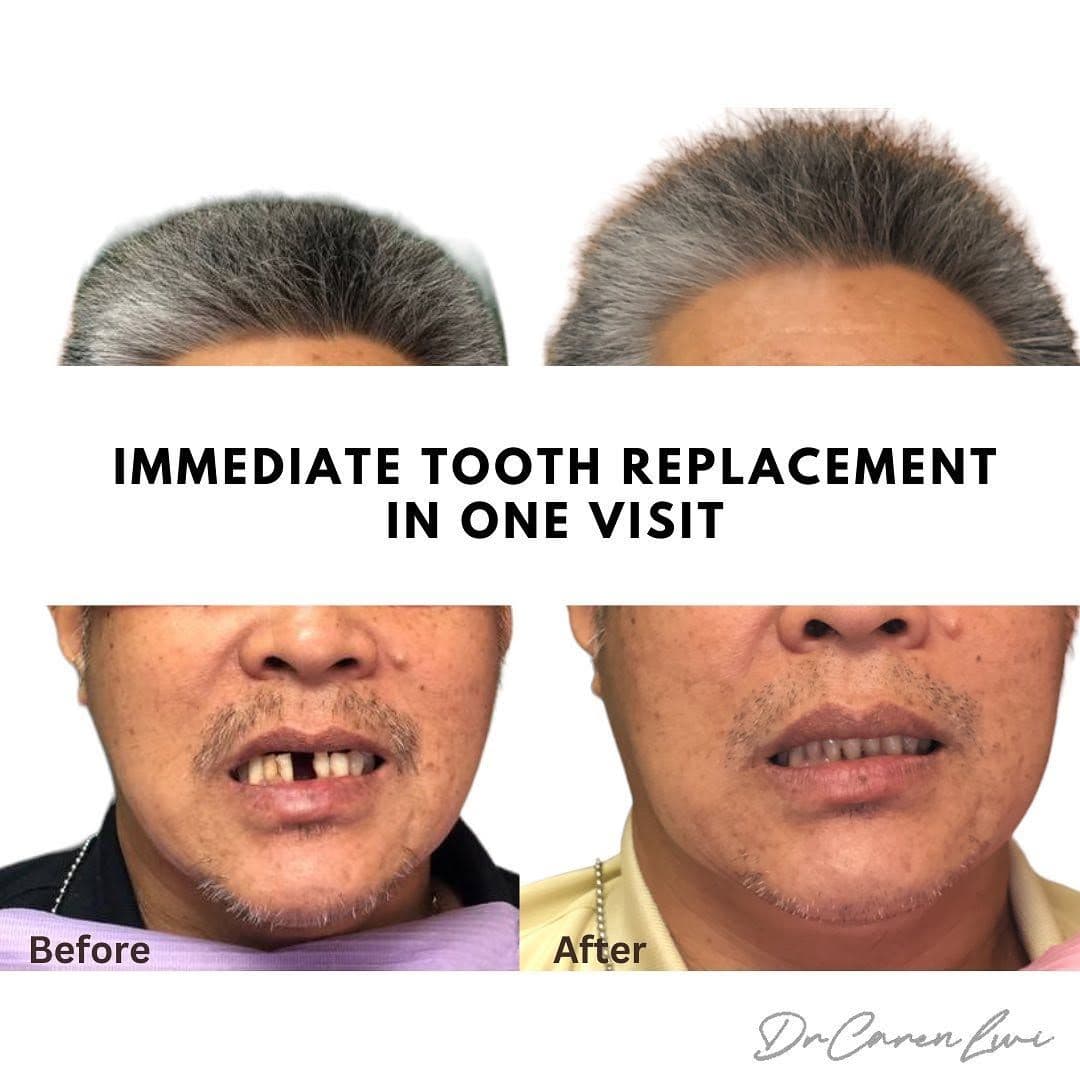 Aloha Dental smile result 3